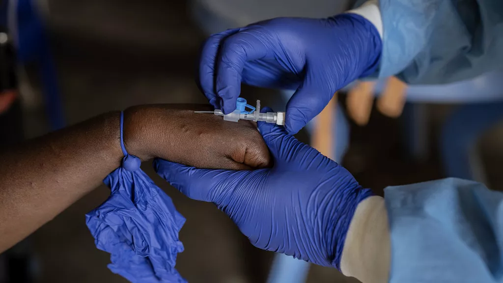 The CDC in Africa Supports Morocco’s Mpox Test